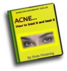 ACNE - How to treat it and beat it